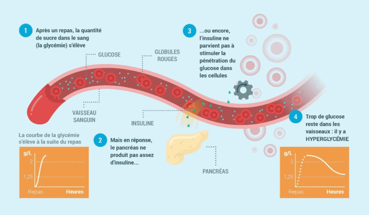 Régulation de la glycémie chez une personne atteinte de diabète (Source: CEED, 2018)